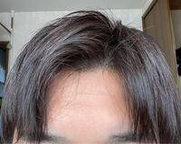 前髪上げた時にどうしてもこういうちょろちょろした毛が出てきて上手くまとまらない Yahoo 知恵袋