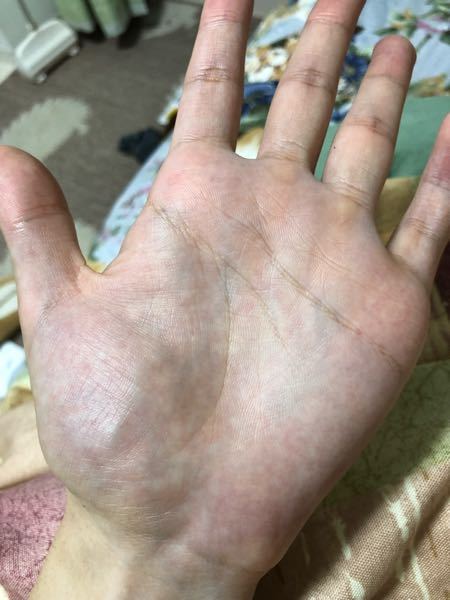 僕の手相を占ってください 詳しい方よろしくお願いします 感情線と頭脳線 Yahoo 知恵袋