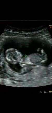 昨日13週の妊婦健診に行ってきました 1人目が男の子のため性別 Yahoo 知恵袋