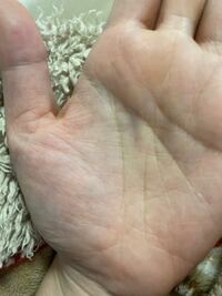 これは 神秘十字線ですか 知能線と感情線の間かつ 運命線の沿線に出ていま Yahoo 知恵袋