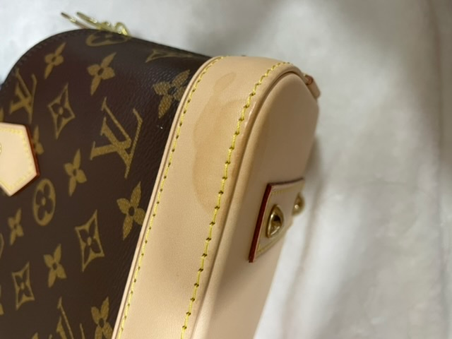 【決まりました】ヴィトン アルマ 中古 シミ汚れ有り ヴィトンアルマbbの汚れについてこれはなんの汚れでしょうか？気づい