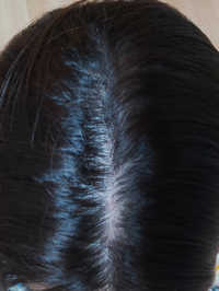 30代前半の女です 最近なんとなく抜け毛が多い 前髪が薄いなと思っていたんです Yahoo 知恵袋