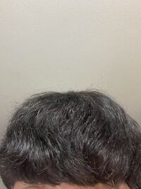 髪がチリチリのくせ毛です 本当に悩んでます 友達には陰毛みたいといじられ Yahoo 知恵袋