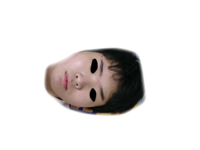 少し怖いので閲覧注意 これはどういう鼻でしょうか 自分は鼻とかには詳しくなくて Yahoo 知恵袋