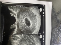 この度妊娠致しまして 8 12に病院で検査を受けた所 胎嚢は22mmあるけどま Yahoo 知恵袋