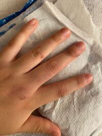 世の中には車を擦った程度では警察に連絡しないという人が多くいる Yahoo 知恵袋