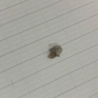 閲覧注意です 勉強中にふとおへそが気になって いけないことだとわかって Yahoo 知恵袋