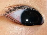 赤ちゃんの目に付いてです 生後6ヶ月の赤ちゃんですが 先程よく Yahoo 知恵袋