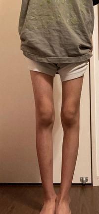 私は小学6年生の身長140cm 体重24kgです 私はまだ自分が太っ Yahoo 知恵袋