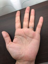 手のひらのほくろについてです 今日気がついたのですが以前はなかった場所 左 Yahoo 知恵袋