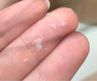 これカンジダですか ཫ 色や匂いに問題ないのですが 少々 Yahoo 知恵袋