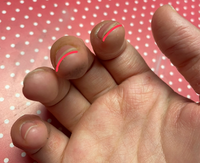 音ゲーをやっていて中指と人差し指を使うのですが 指のアトピーとタップ Yahoo 知恵袋
