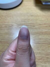 爪のピンク色の部分が割れたとしても 元に戻るのでしょうか 専門家ではな Yahoo 知恵袋