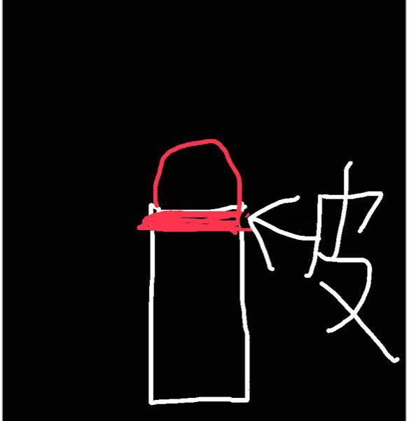 POURQUOI L'HÉMOCHROMATOSE PROVOQUE-T-ELLE UNE DYSFONCTION ÉRECTILE