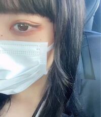 至急小松菜奈ちゃんが好きで鼻のところにほくろ描いてるんですけどない方がいいと思 Yahoo 知恵袋