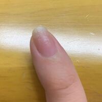 爪が白くガサガサになります ネイルなどは何もしていません 何が原因ですか Yahoo 知恵袋