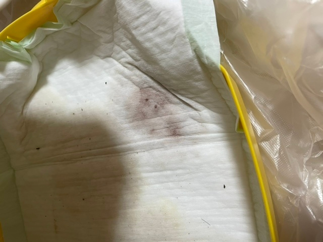 来月１歳になる飼い猫のトイレシートを見たら血がまざったような尿が出 