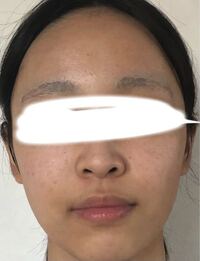 高校生女です 自分は肌が汚いですぶつぶつがあって 肌の色にムラが Yahoo 知恵袋