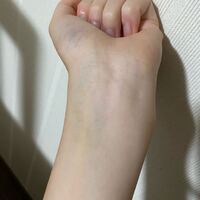 もうすぐ妊娠35週です 胎動が日に日に激しくなり ほんと痛いです 夜もグリグリ Yahoo 知恵袋