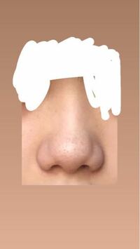 痩せると団子鼻は改善されますか 175キロで70キロあります 60キロ Yahoo 知恵袋