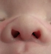 すごく気になる悩みがあります 私は子供の時から鼻の穴がハート型です 下から見 Yahoo 知恵袋