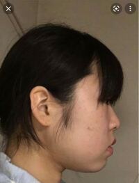 私はとても横顔がブサイクで悩んでます 写真みたいな感じの横顔です 口 Yahoo 知恵袋