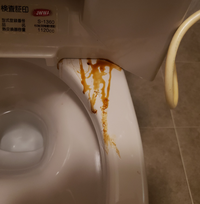 引越先のトイレを掃除したら 便座を上げたところに茶色のベトベトした接着剤のよう Yahoo 知恵袋