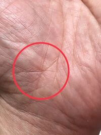 手相について 徐々にハッキリしてきました これは星紋 スター線 とい Yahoo 知恵袋