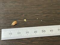 でかい耳垢とれました 何かの病気だったりしますか Yahoo 知恵袋