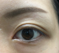 汚い画像ですみません アラサー女です 元々自分の肌が荒れやすく悩んでいたのです Yahoo 知恵袋