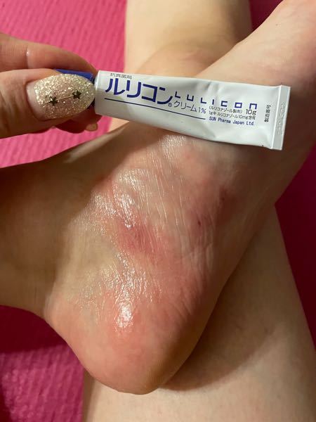 水虫 解決済みの質問 Yahoo 知恵袋