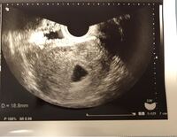 本日検診に行きました 恐らく7w過ぎくらいだと思いますが 心拍について先 Yahoo 知恵袋