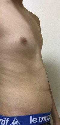 高校生男子です 最近お腹がでてきました 張っている感じではなくて 柔らかいです Yahoo 知恵袋