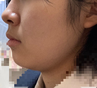 至急 高校生です 159cm47 くらいなのですが 私は顔に脂肪が付きやすい Yahoo 知恵袋