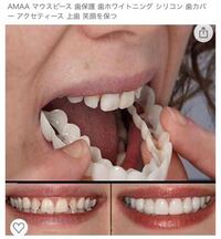 矯正目的ではなく歯の汚さや割れ 抜けを隠すための目的で作って貰うことができる場 Yahoo 知恵袋