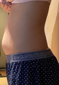 私は胃下垂ですかね この下腹のぽっこりをどうにかしたいです 女子です Yahoo 知恵袋