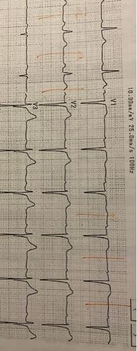 医療者関係の方に質問です お医者さんや看護師さんに この Yahoo 知恵袋