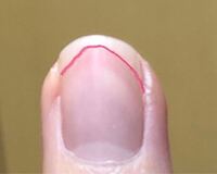 爪の上の白い部分の形が変なのですが 編集で線を引きました どうすれば綺麗な形 Yahoo 知恵袋