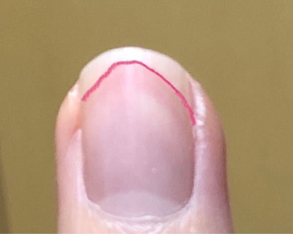 爪の上の白い部分の形が変なのですが 編集で線を引きました どうすれば綺麗な形 Yahoo 知恵袋
