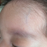 赤ちゃんの頭に青筋 生後1ヶ月と5日の子供を持つ新米ﾏﾏです 数日前に子供 Yahoo 知恵袋
