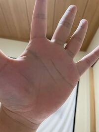 画像 手相の生命線が異常に短いですやっぱり早死にしますか 昔はもっと Yahoo 知恵袋
