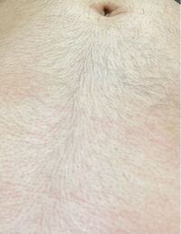 女です 以前から女なのにギャランドゥーが生えます 剃刀で剃ってもポツポ Yahoo 知恵袋