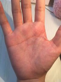 手相のこと くっつき知能線のことで悩んでいます この手の質問を何度もさせ Yahoo 知恵袋