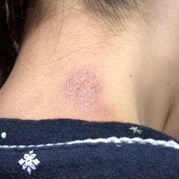 皮膚がカサカサで痒いのですが何だと思いますか 今の時期 乾燥のせいか Yahoo 知恵袋