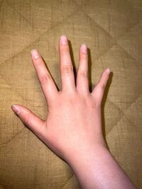 手がとてもコンプレックスです 関節 のところがしわしわで手のひらも分厚いし指の Yahoo 知恵袋