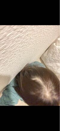 私は抜毛症です もうほとんど髪がありません 髪を伸ばしてパー Yahoo 知恵袋