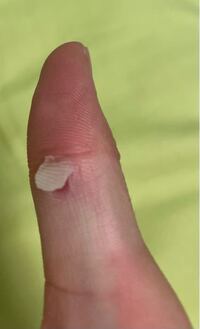 ベースでスラップの練習をしていたら途中で指の皮がめくれてしまいました Yahoo 知恵袋