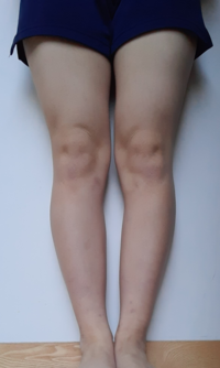 脚を細くして痩せたいです 1年間くらいかけて脚を細くしたいなと考えてま Yahoo 知恵袋