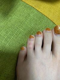 左足の足の薬指だけに謎の発疹 赤い斑点 が2 3ヶ月前からあります Yahoo 知恵袋