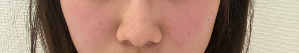 鼻がでかく、左右非対称なのが悩みです。 客観的に見てどう感じますか。